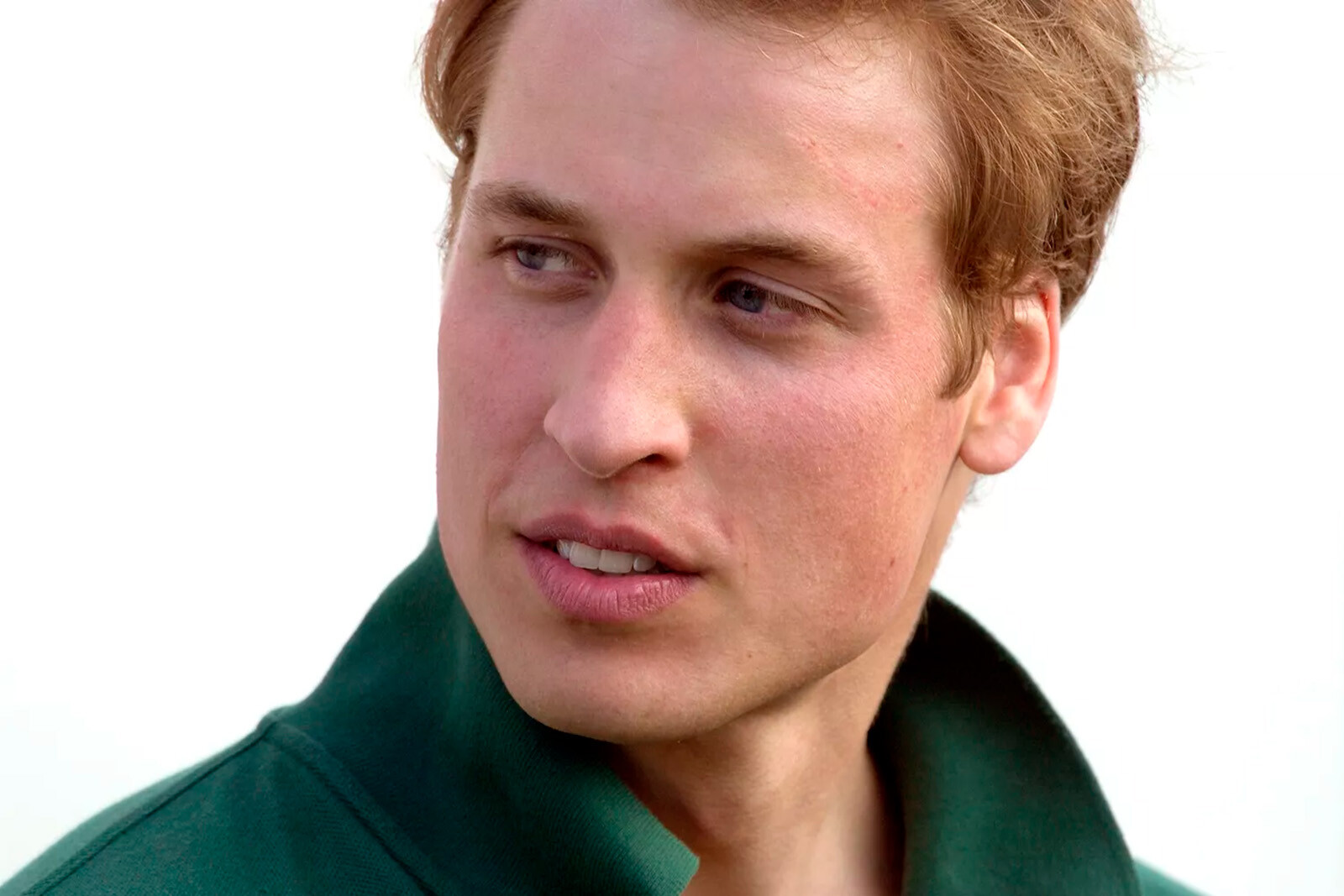 Prince-William-has-scar-on-his-forehead-002-Mainstyle.jpg